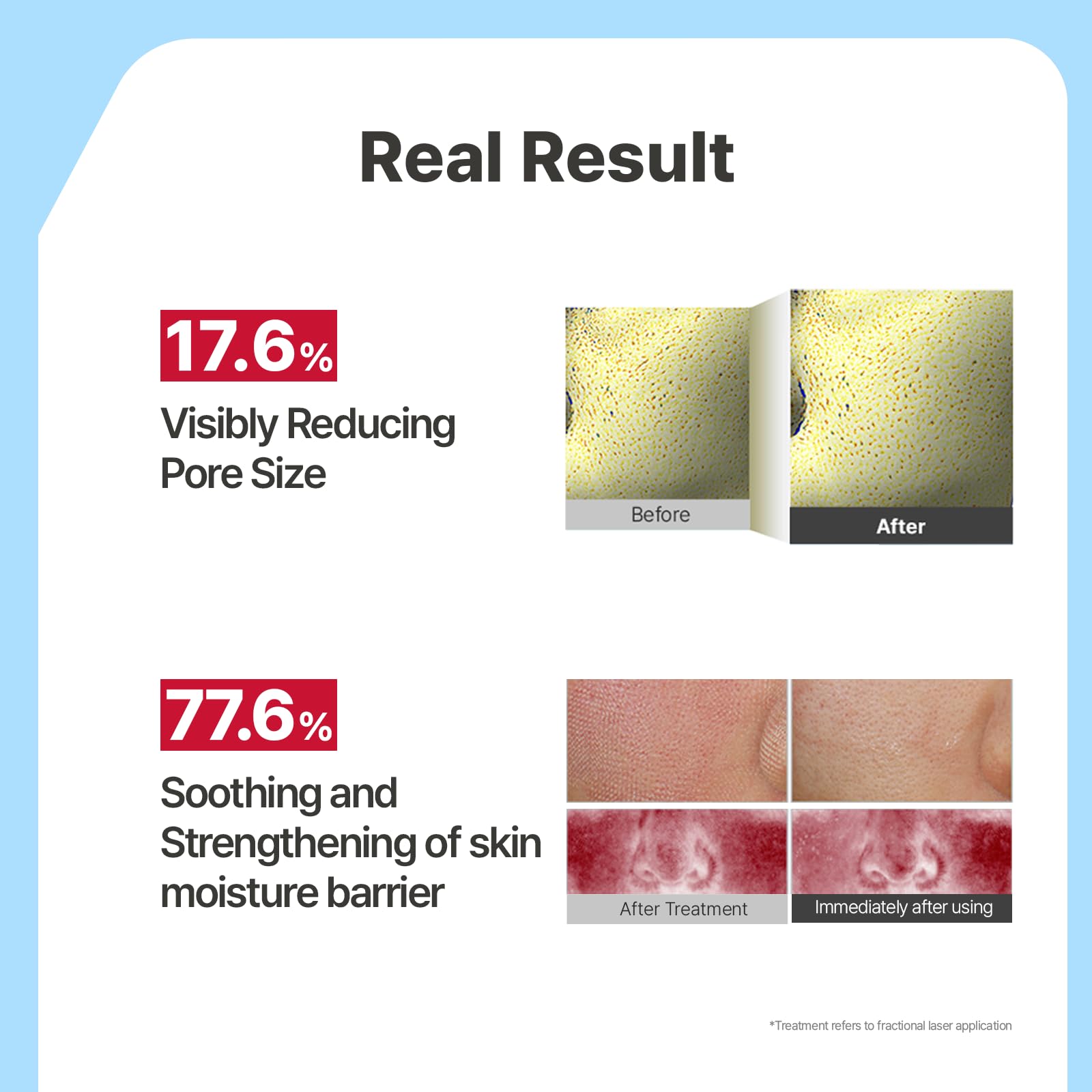 Illiyoon Ceramide Ato Concentrate Gel Face Mask - Illiyoon Official Product Imagery - 6