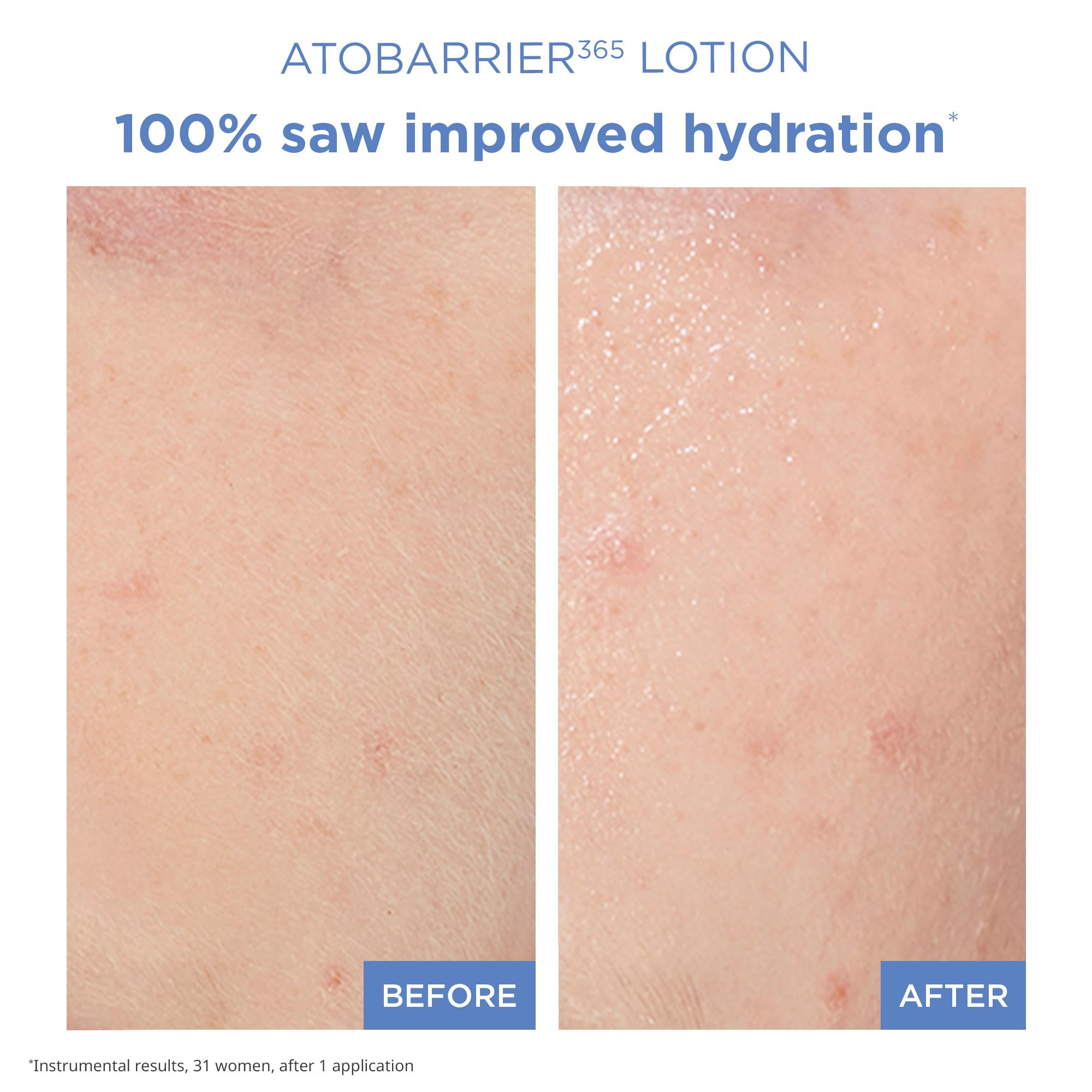 AESTURA ATOBARRIER365 Lightweight Korean Face Moisturizer with Ceramides - - AESTURA Official Product View 5