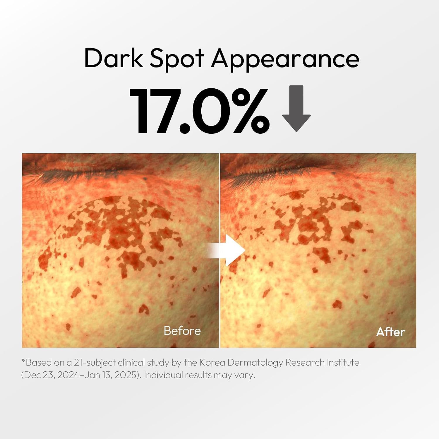 LAYERLAB Clear Tone Dark Spot Serum Niacinamide 7 Face Serum - LAYERLAB Official Imagery - 4