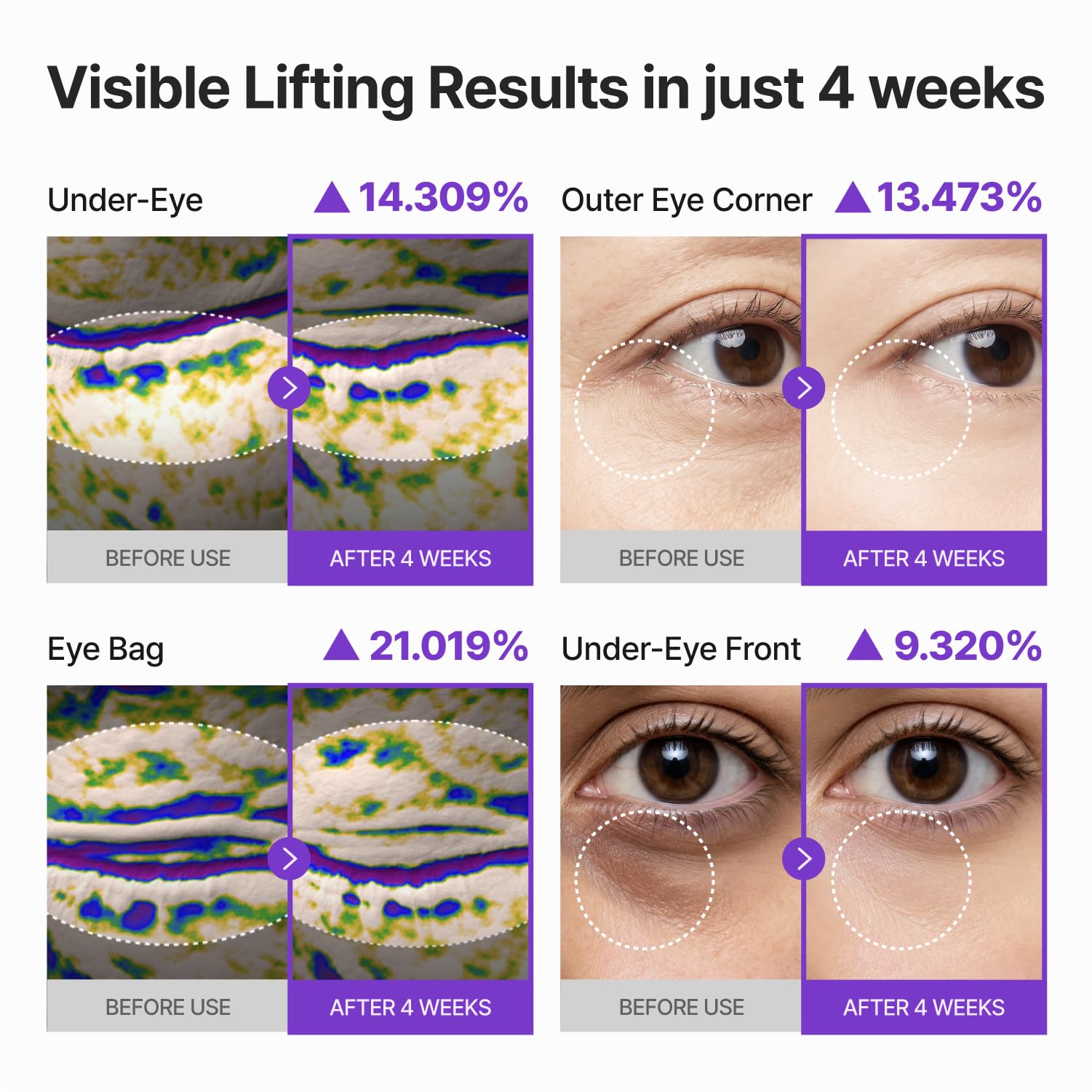 CENTELLIAN 24 360 Shot PDRN Firming Eye Cream TECA Retinol - CENTELLIAN 24 Official Product Imagery - 7