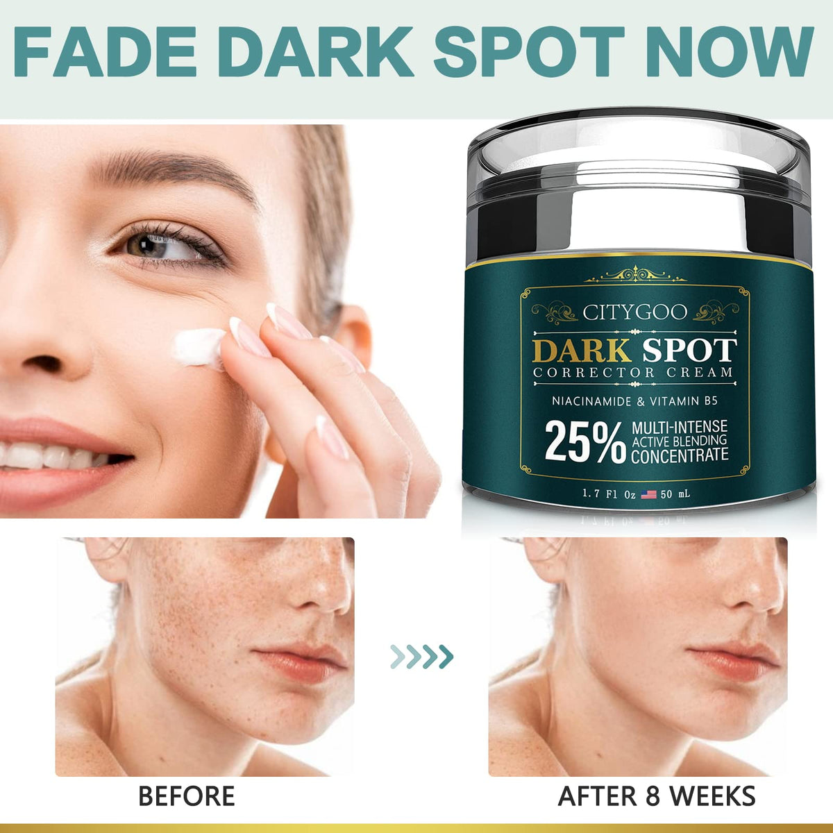 Dark Spot Remover for Face Dark Spot Corrector Cream - CITYGOO Official Imagery - 3