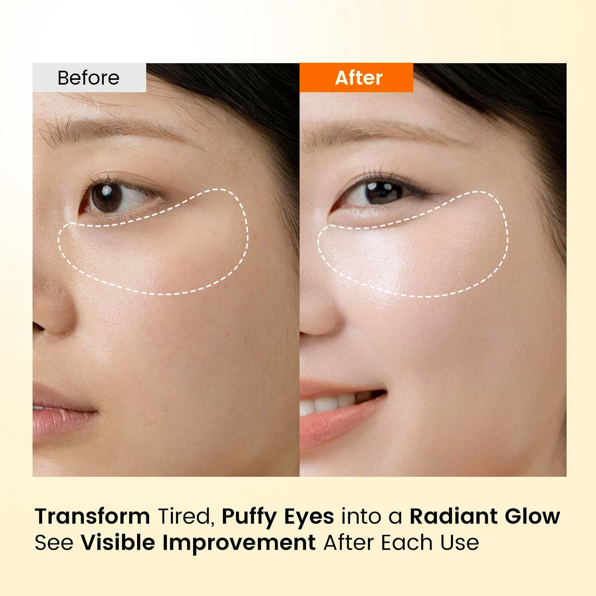 Under Eye Patches for Dark Circles Puffy Eyes Puffiness - SEONGLOW Official Imagery - 4