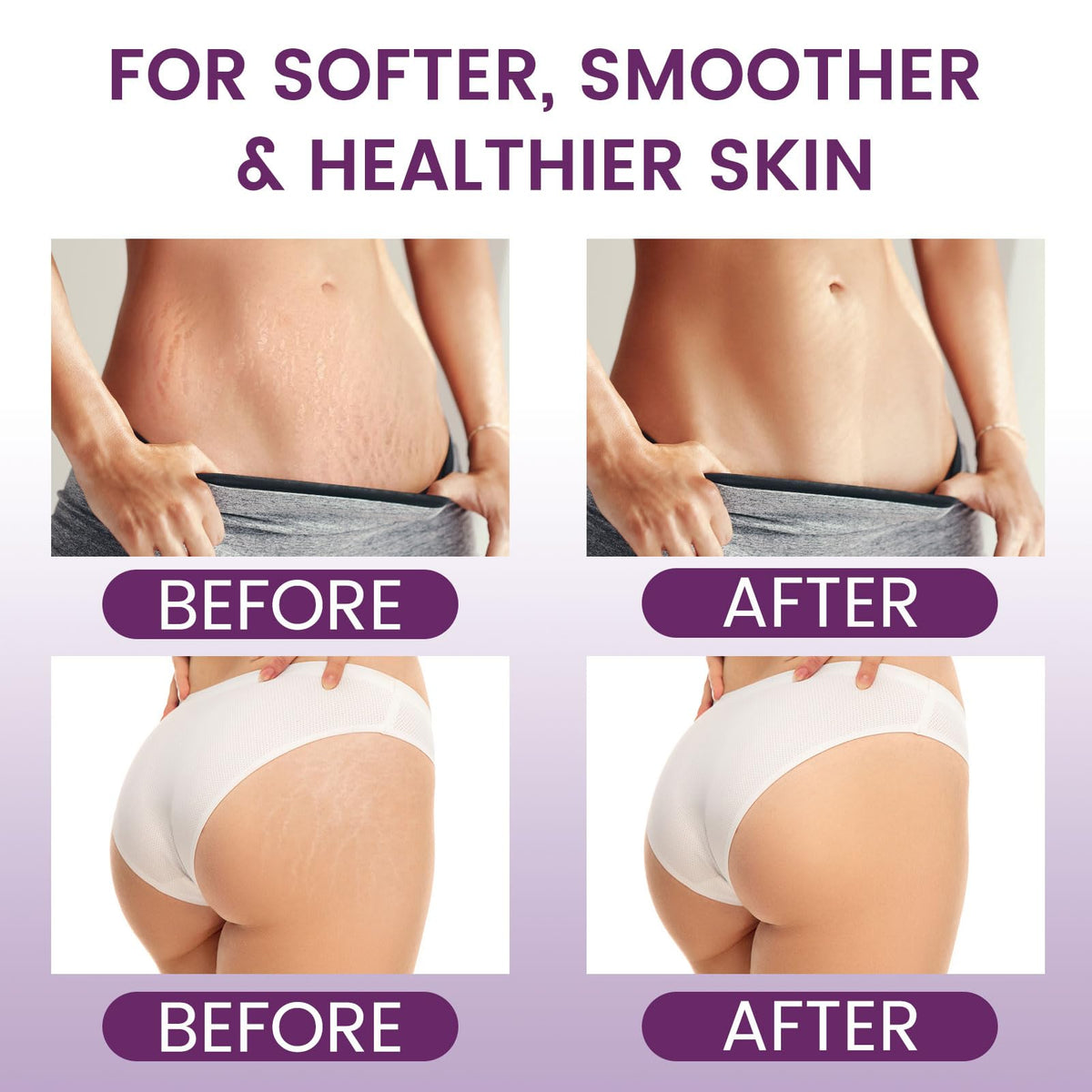AOAO Pregnancy Moisturizing Skin Care Set Safe Support Skin - AOAO Official Imagery - 5