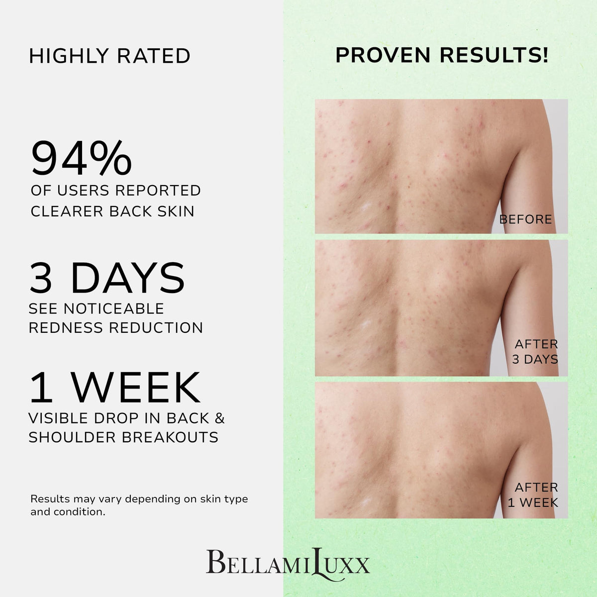 BellamiLuxx Back and Body Acne Treatment Spray 2 Salicylic - BellamiLuxx Official Imagery - 4