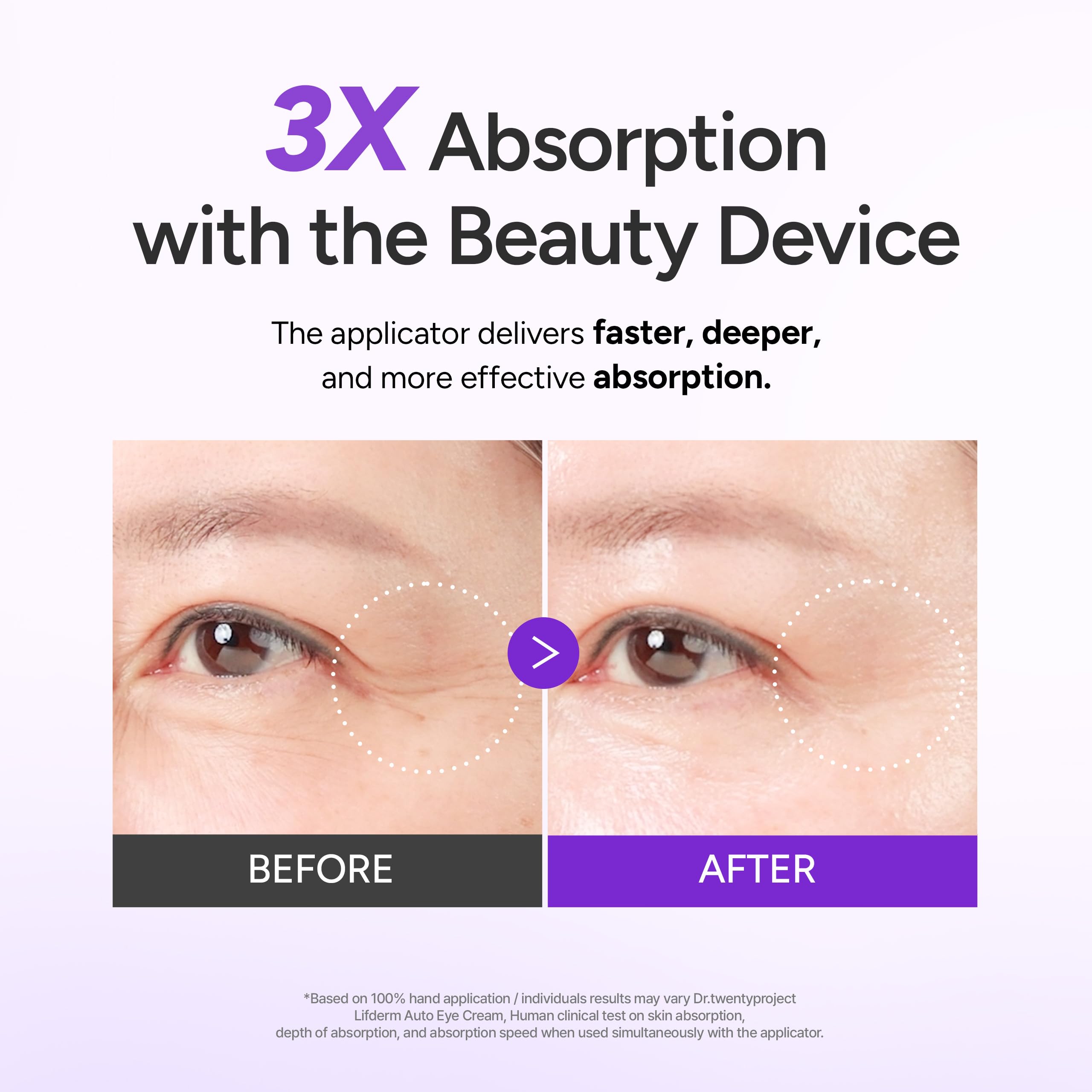 Lifderm Eye Cream with Collagen Vibrating Device for - Dr.twentyproject Official Imagery - 4