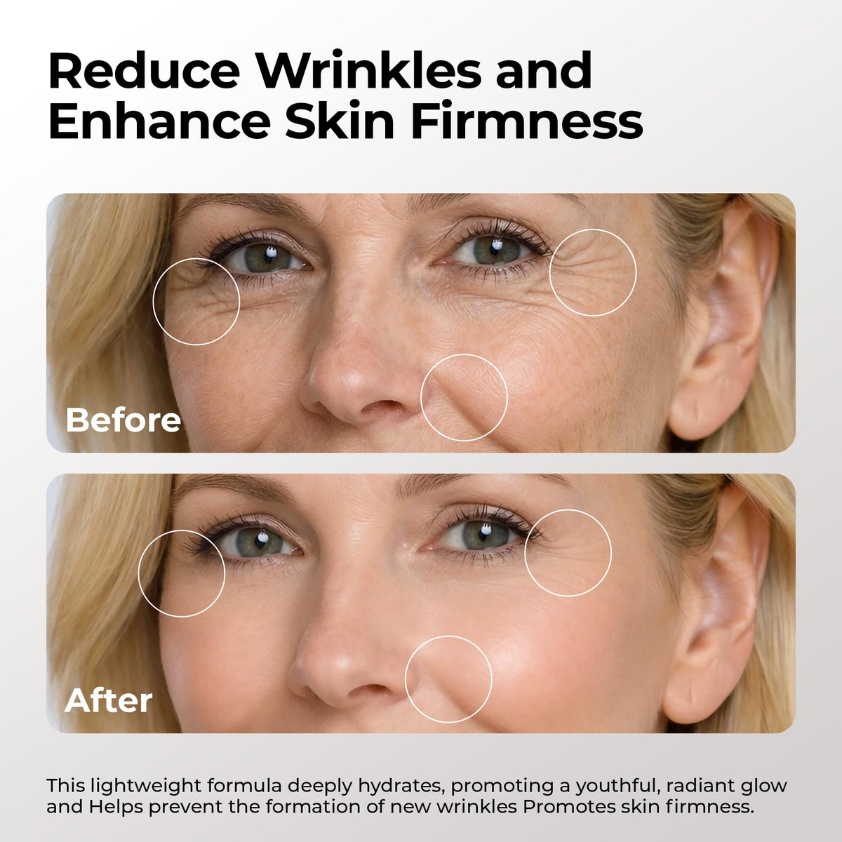 SKIN DEVA Youthful Glow Skincare Bundle Argireline Serum - SKIN DEVA Official Imagery - 6