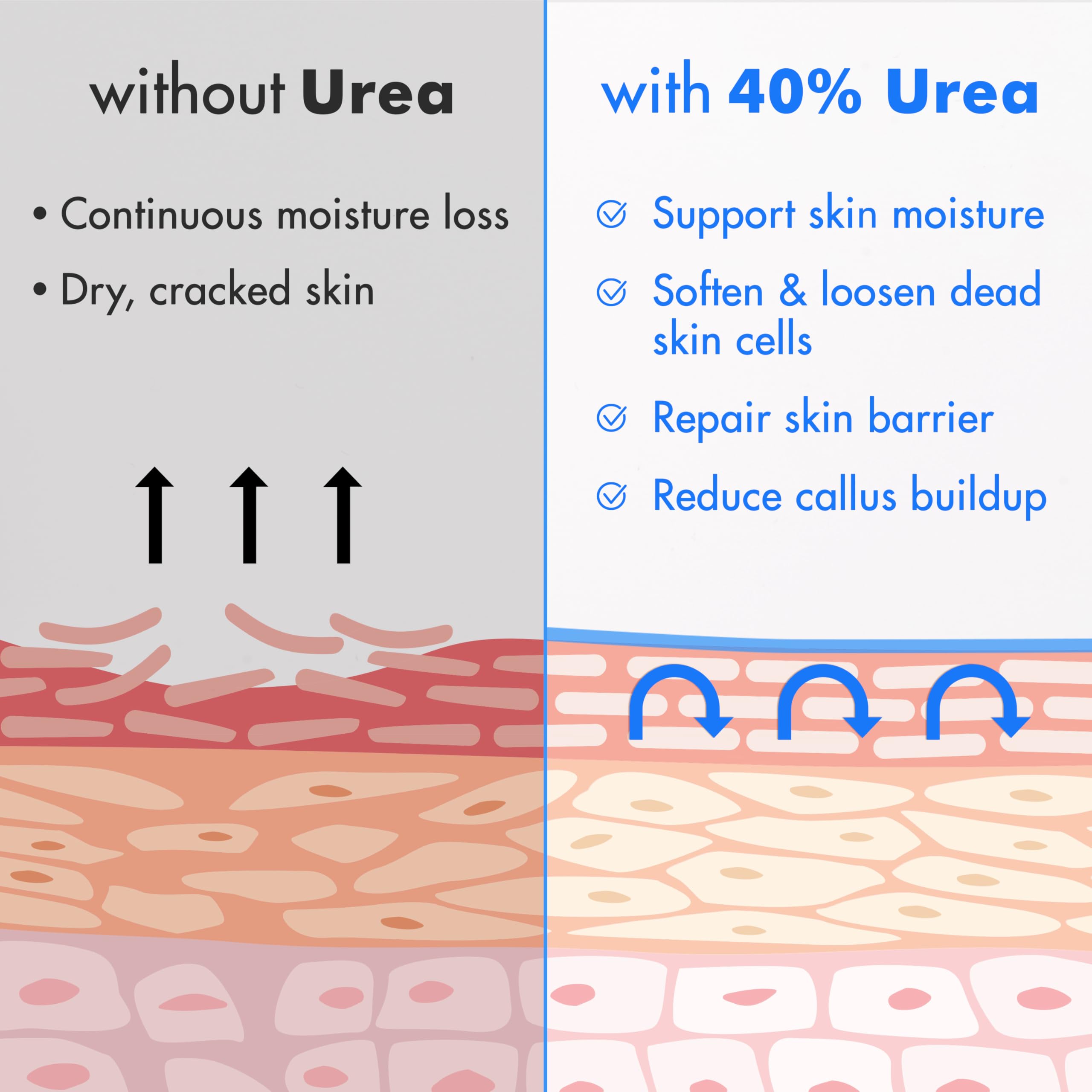Ebanel Urea 40% moisturizer cream in a 4oz jar, designed for dry cracked feet and heels, with a smooth, creamy texture.