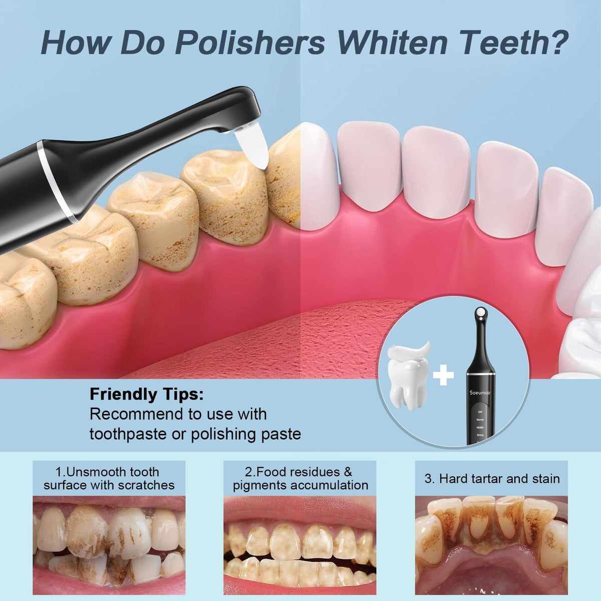 Tooth Polisher Rechargeable Tooth Whitening Kit for Teeth - Soeumoir Official Imagery - 3