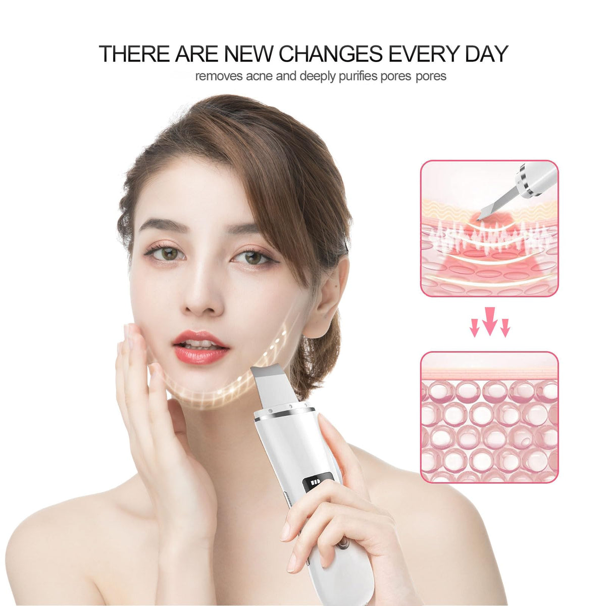 Face Scrubber Skin Spatula Blackhead Remover with 4 Modes - FENNIDICE Official Imagery - 5
