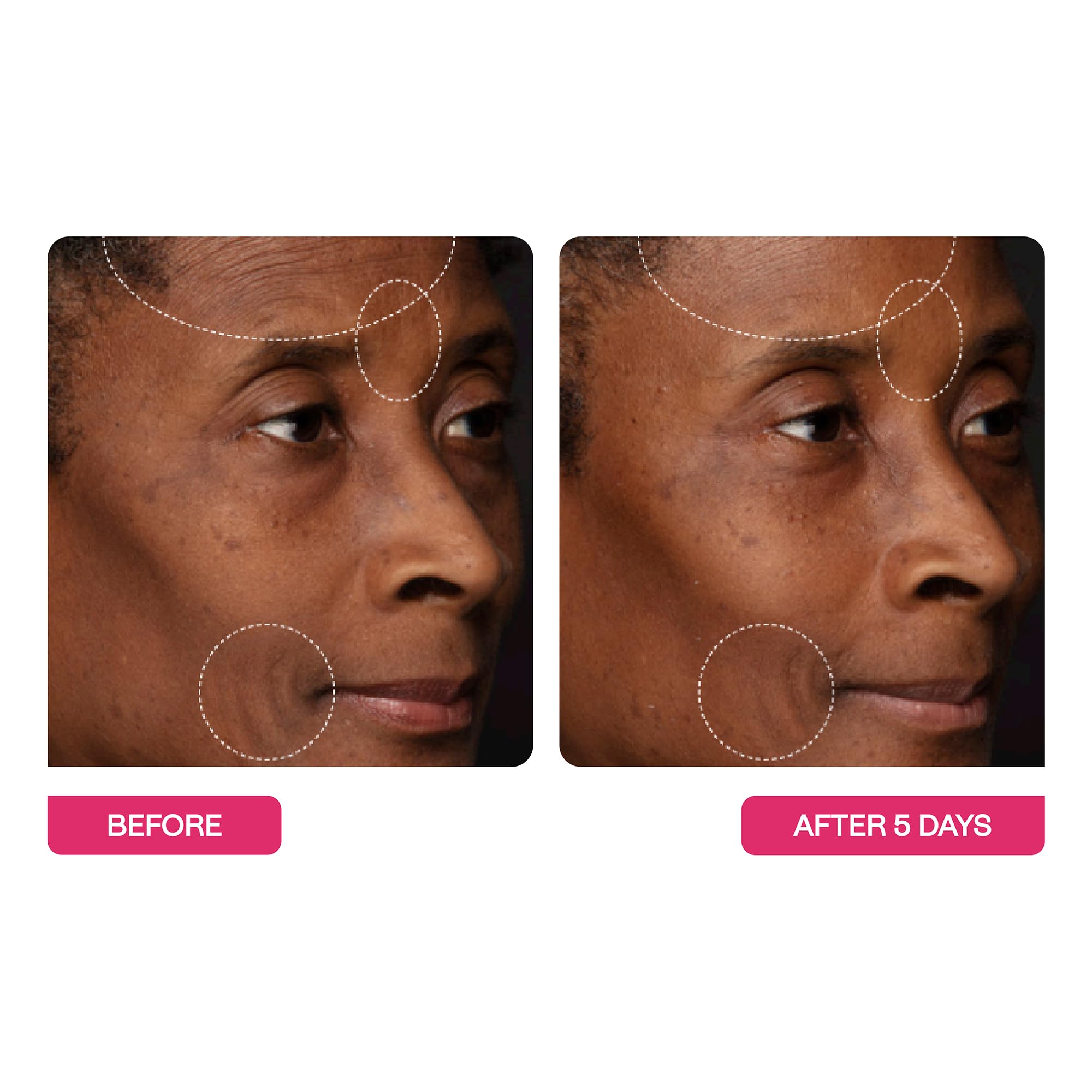 BeautyStat Peptide Wrinkle Relaxing Moisturizer - BeautyStat Official Imagery - 6