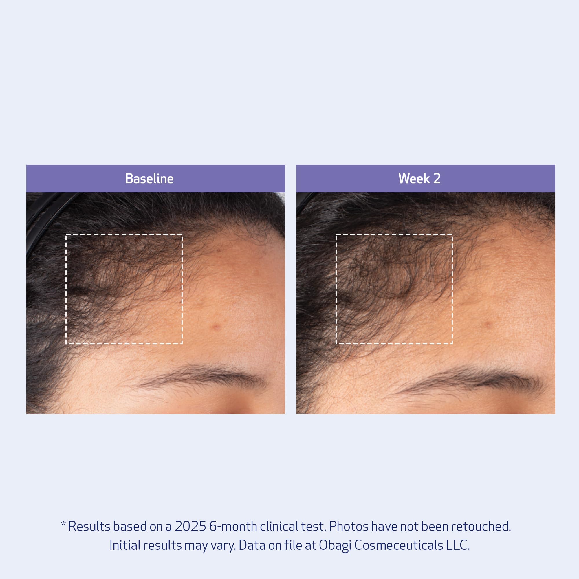 Obagi Nu Cil BioStim Hair Scalp Serum with Biotin - Elefair Store Official Product Imagery - 8