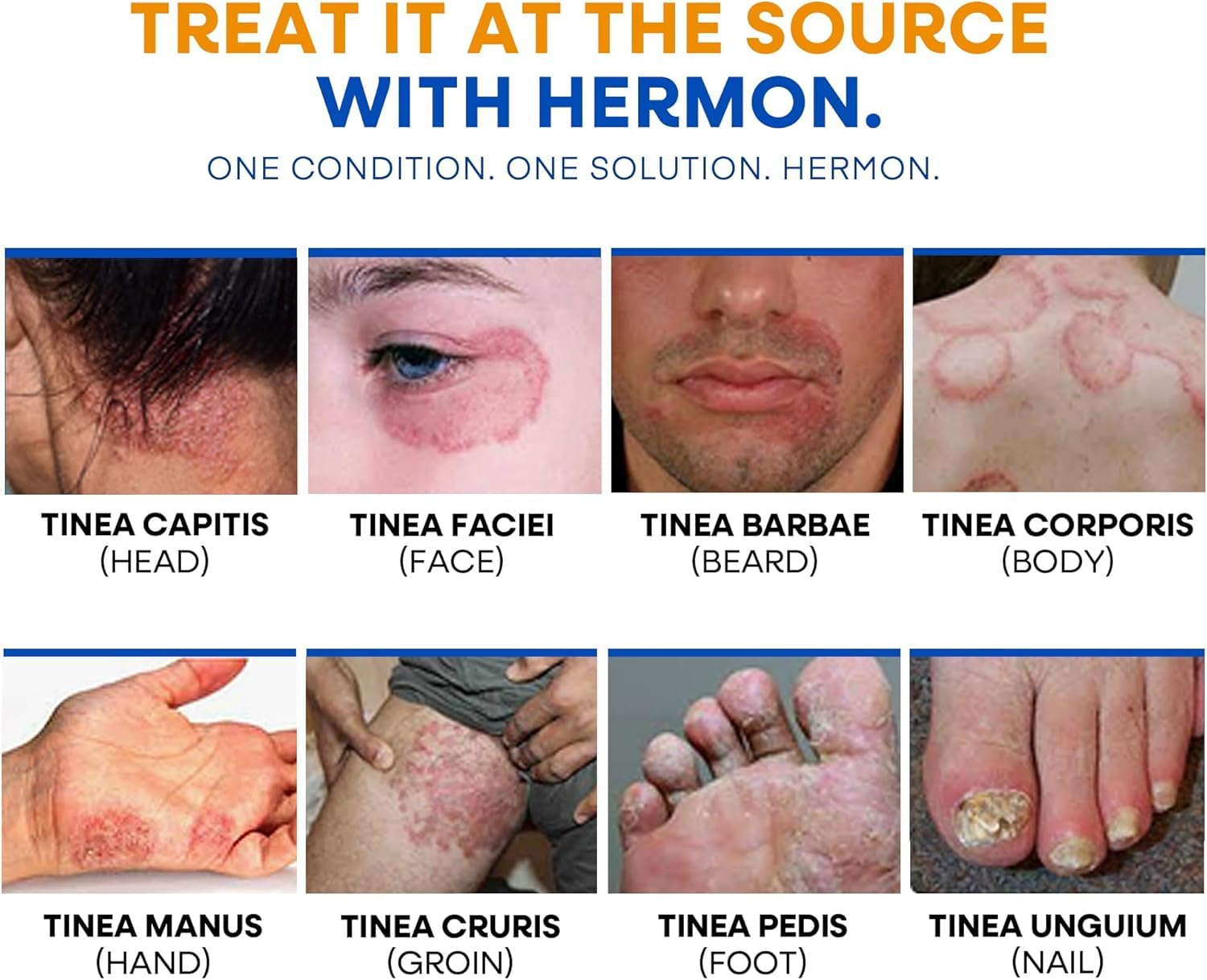 Hermon Antifungal Body Wash 1% Tolnaftate & Tea Tree Oil 500ml