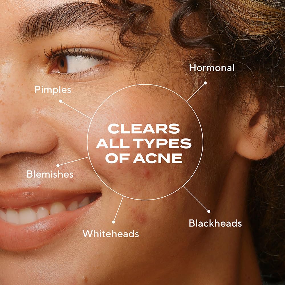 Murad Biome Balancing Acne Serum - Premium Selection Official Imagery - 3