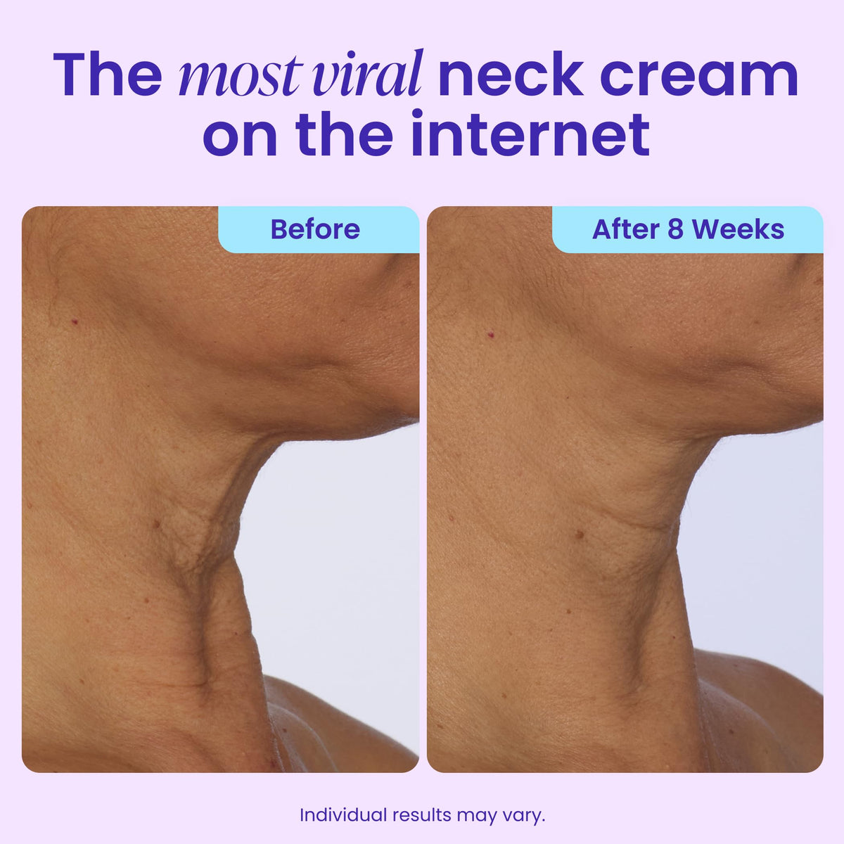goPure Tighten Lift Neck Chest Moisturizer Cream for Visibly - goPure Official Imagery - 4