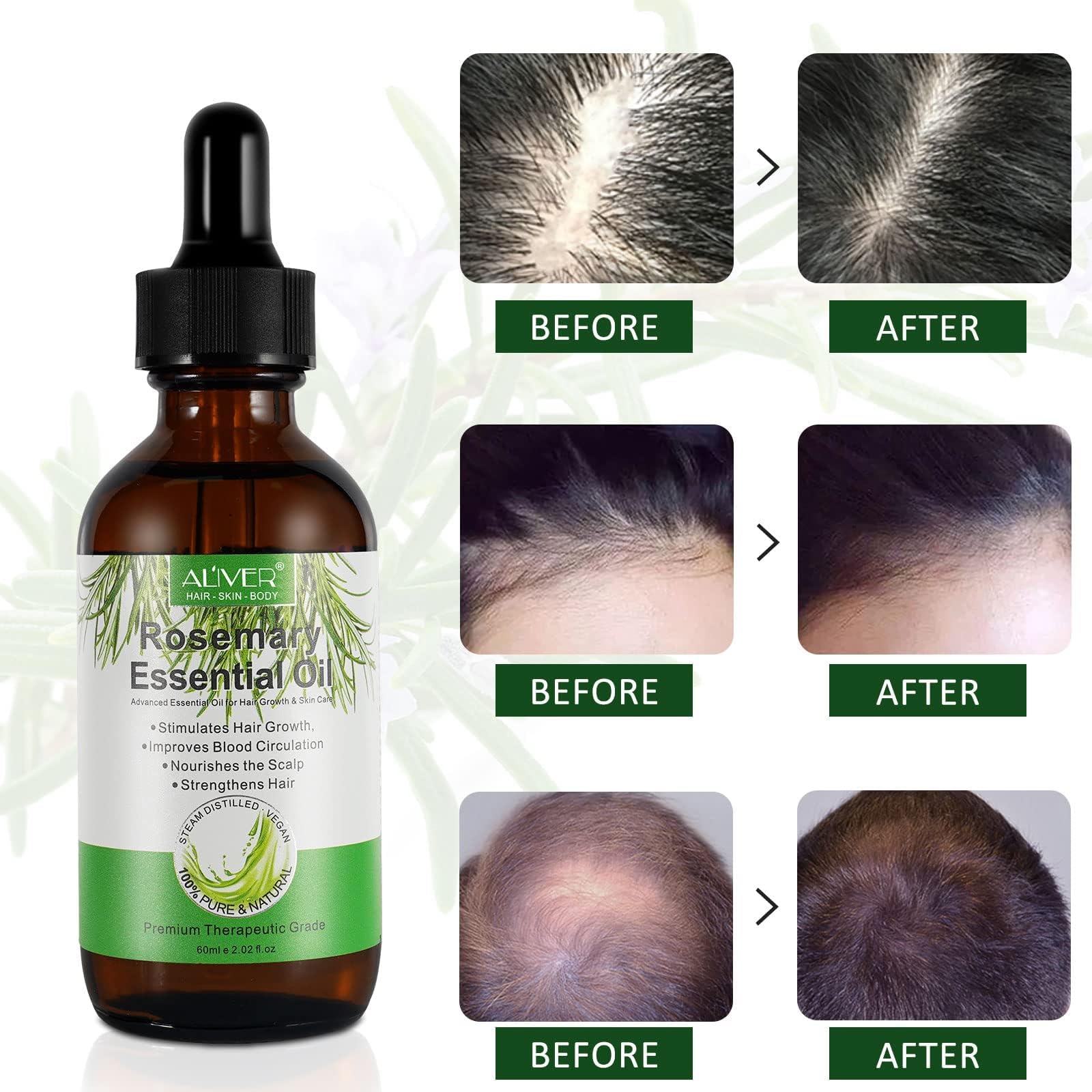 ALIVER Pure Natural Rosemary Essential Oils - & Hair Growth Scalp Oil for Dry Damage - ALIVER Official Product View 3