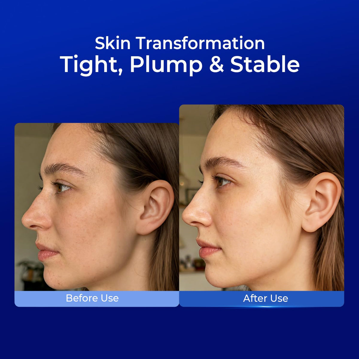 PROFLING Hyaluronic Acid Serum with Copper Peptides Post - PROF.LING Official Imagery - 7