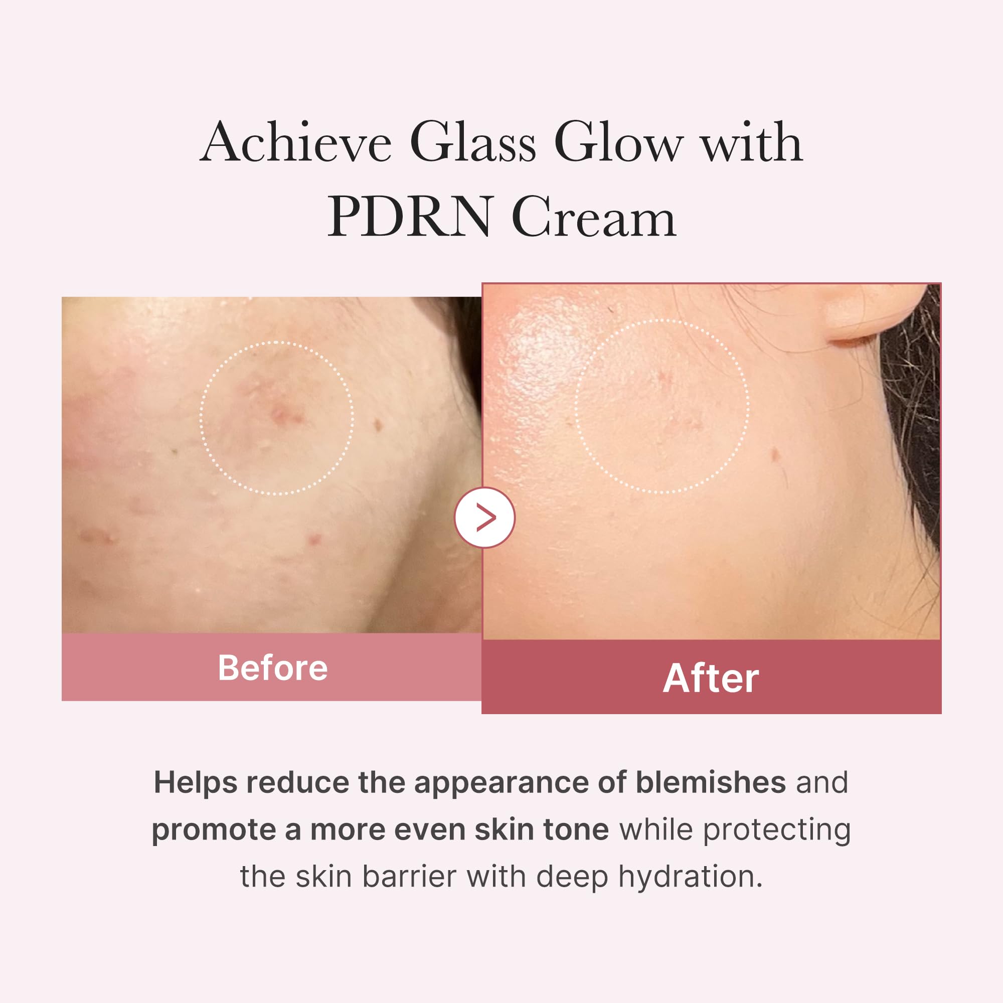 medicube Salmon DNA PDRN Pink Hyaluronic Moisturizing Cream - medicube Official Product View 4