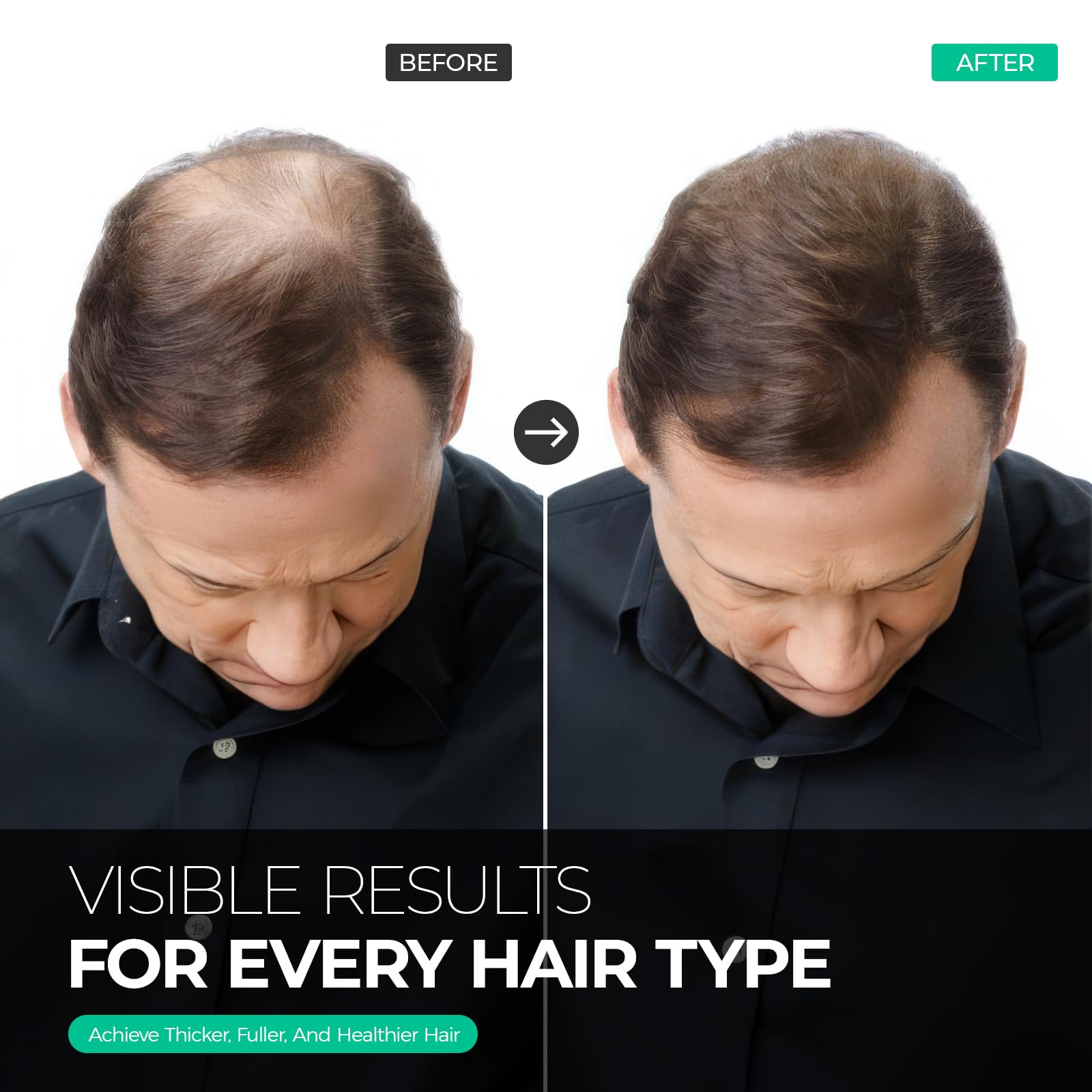 Inlifay Root Activator Shampoo & Conditioner - Hair Growth for Thinning Hair - Inlifay Official Product View 7