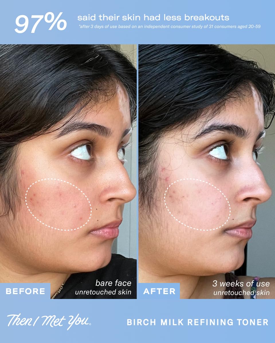 Then I Met You Birch Milk Refining Toner Korean Skin Care - Then I Met You Official Imagery - 8