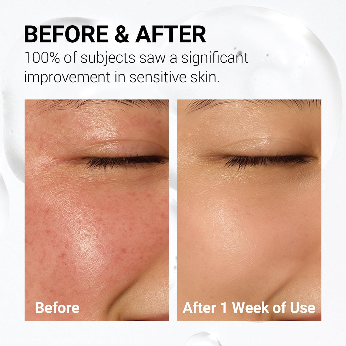 Soothing Calm Toner Pad Daily Gentle Exfoliating Hydrating - NEAF NEAF Official Imagery - 5