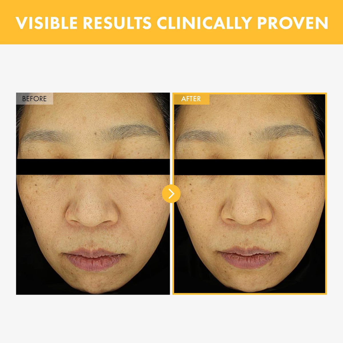 TOSOWOONG 8 Days Spot Cream for Dark Spots Freckles Uneven - TOSOWOONG Official Imagery - 3