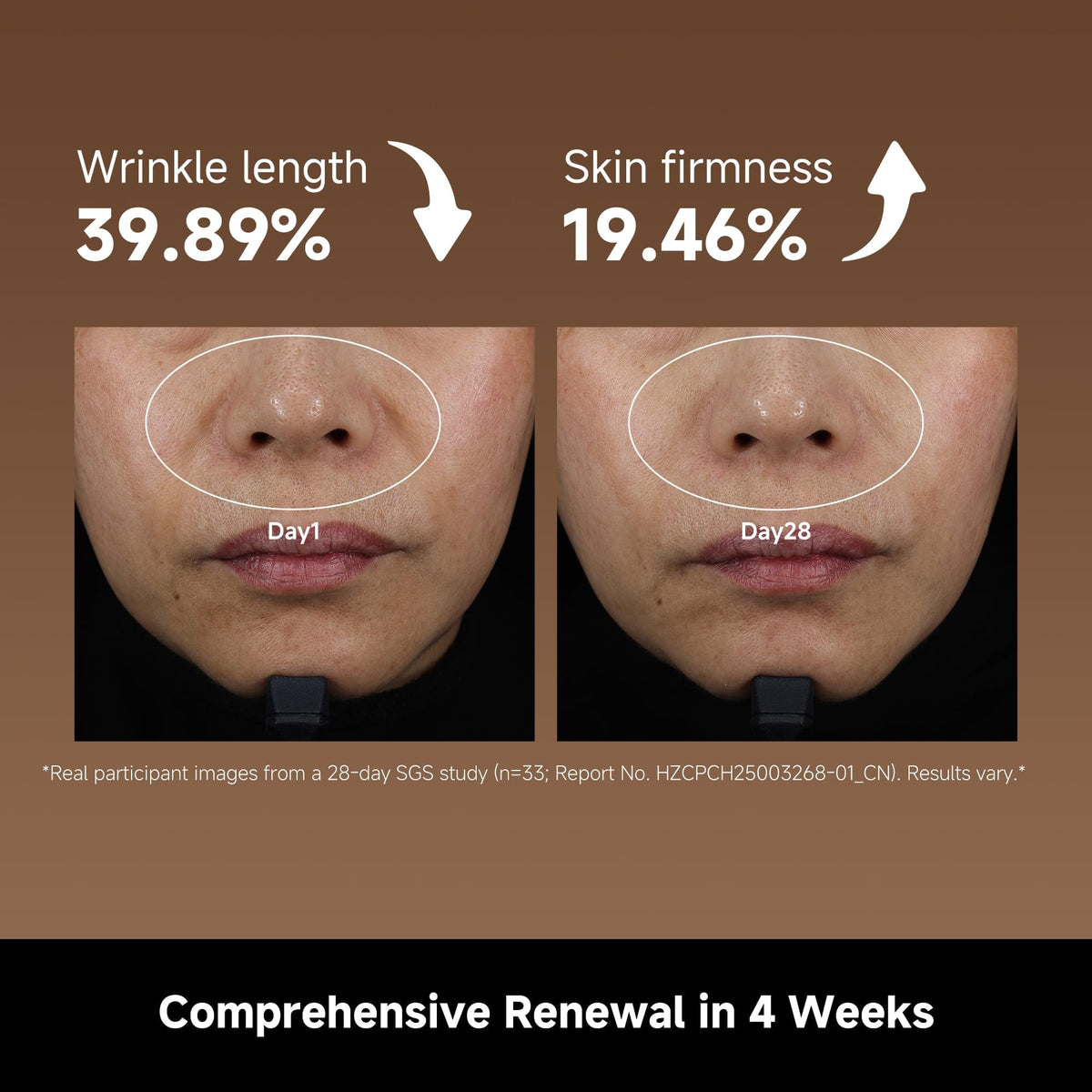 DREAME Chrona Photon Anti Aging Skincare Mask - dreame Official Imagery - 6