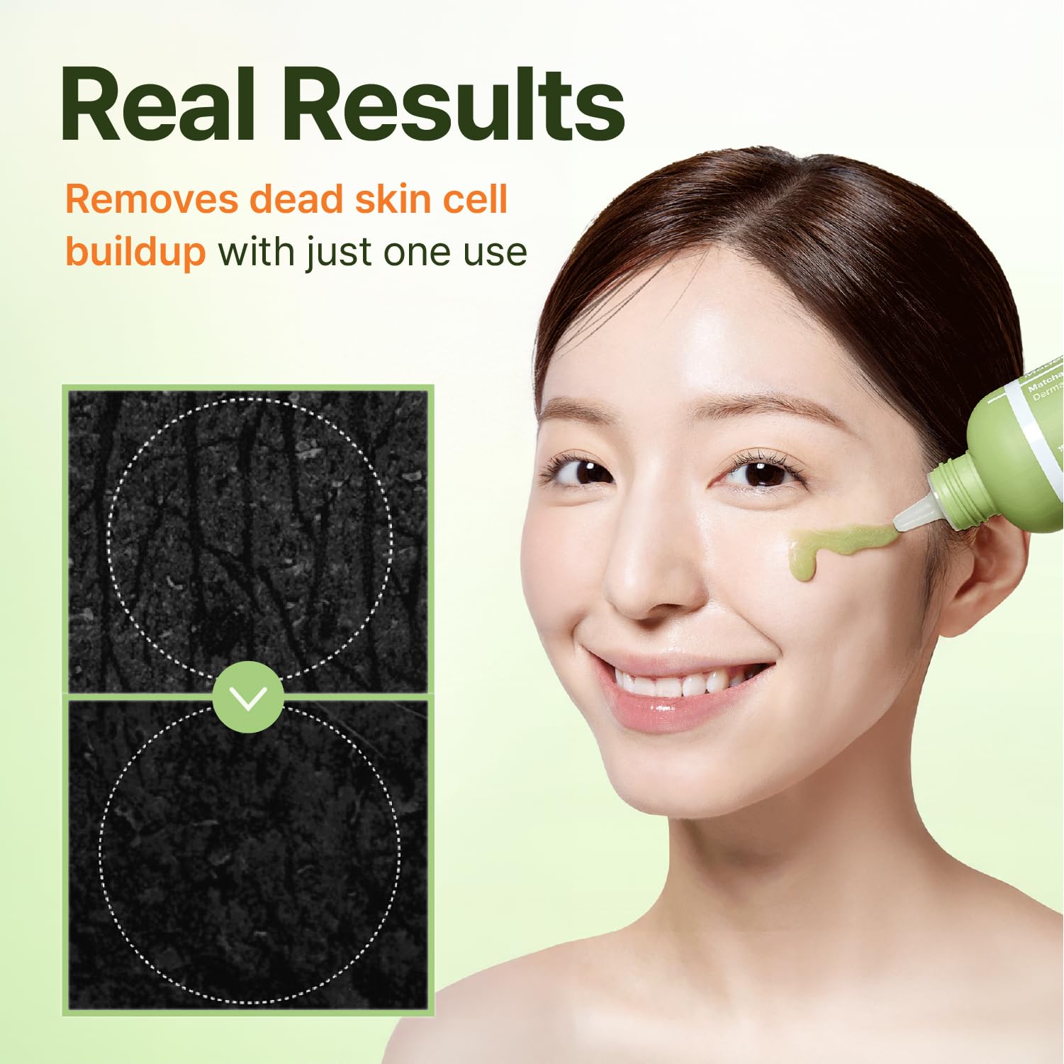 CENTELLIAN 24 Madeca Matcha Toning Peeling Gel - CENTELLIAN 24