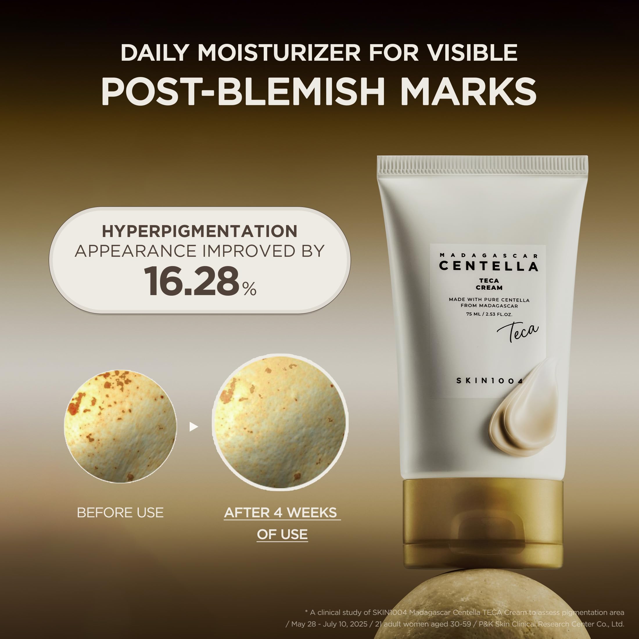 SKIN1004 Madagascar Centella TECA Cream Face Moisturizer - SKIN1004 Official Imagery - 5