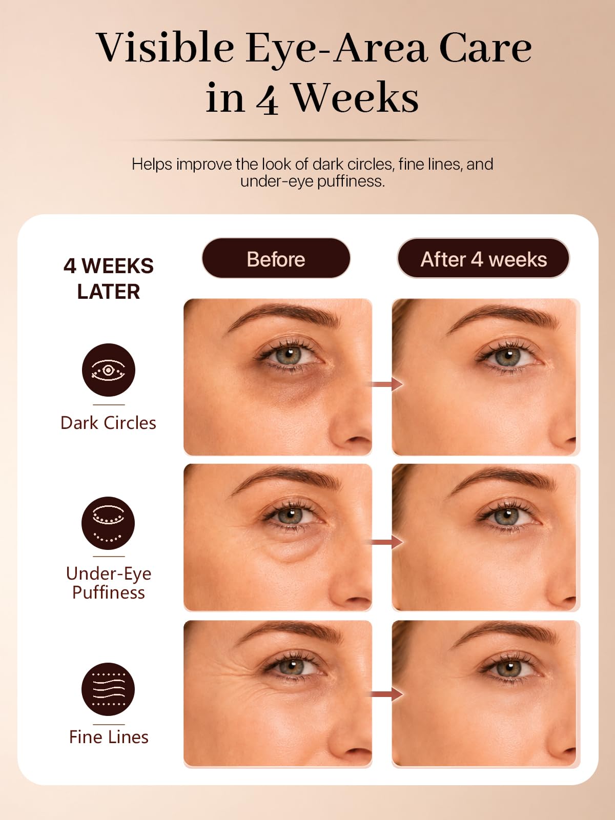 Red Light Therapy for Eyes 630nm 850nm for Dark Circles - YOEYOU Official Imagery - 6