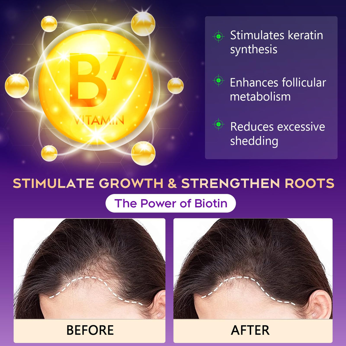 Biotin Hair Growth Shampoo Hair Loss Shampoo for Thinning - oely Official Imagery - 4