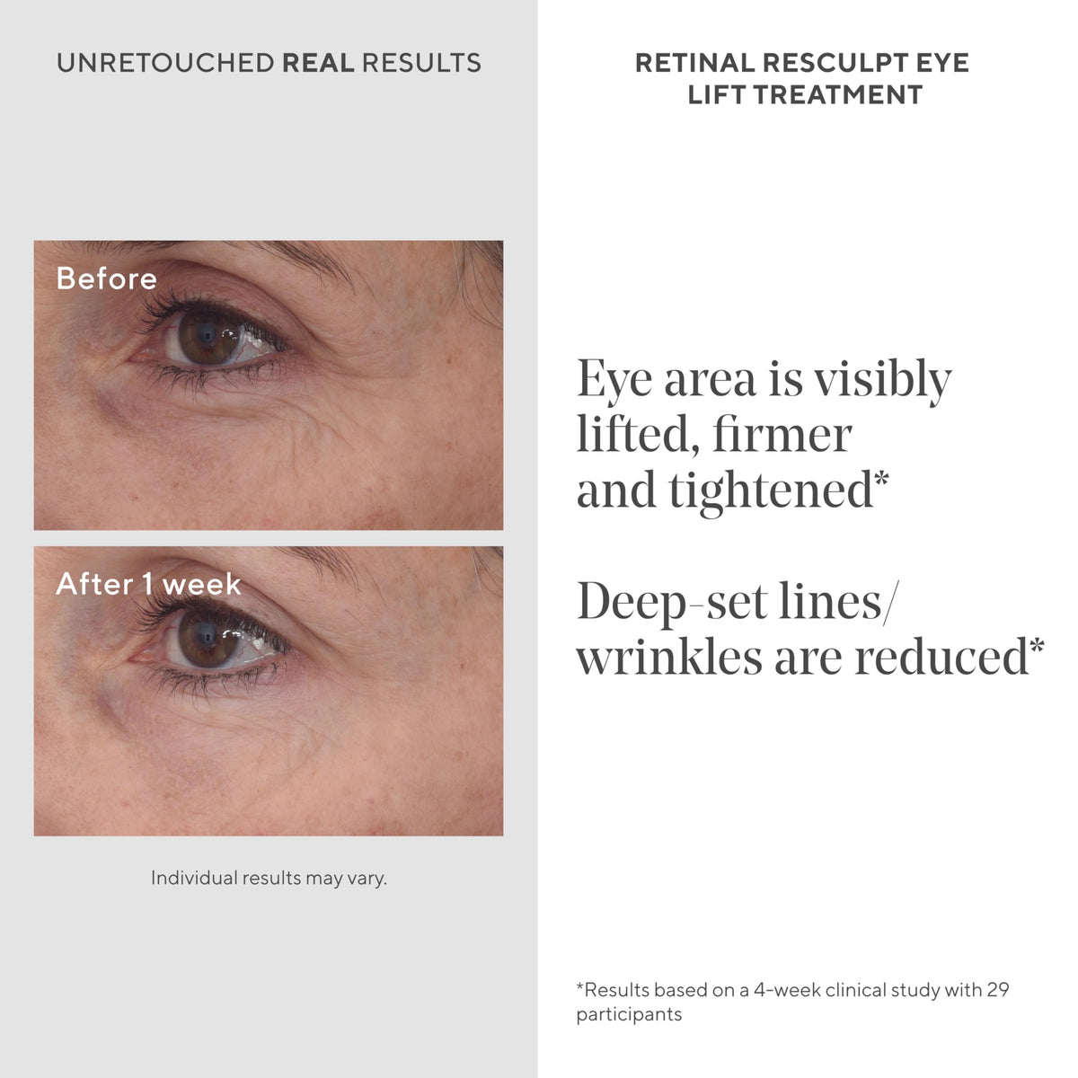 Murad Retinal ReSculpt Eye Lift Treatment - Premium Selection Official Imagery - 4