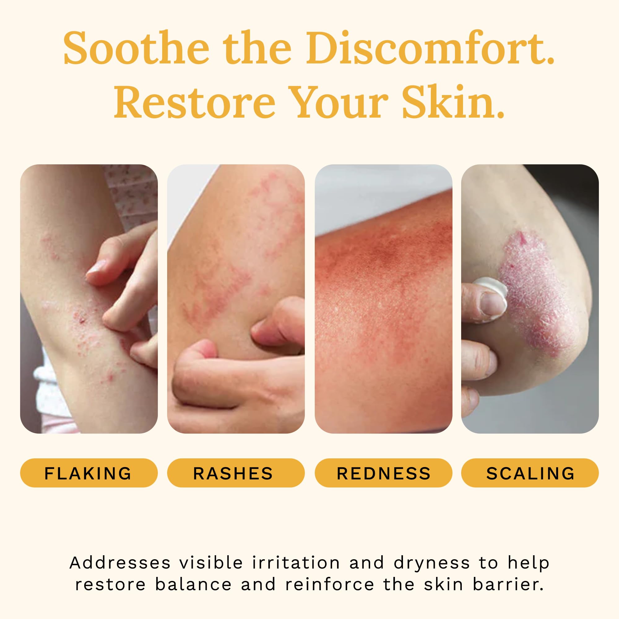Rejuvaskin Skin Recovery Cream 100mL – Radiation & Eczema Relief
