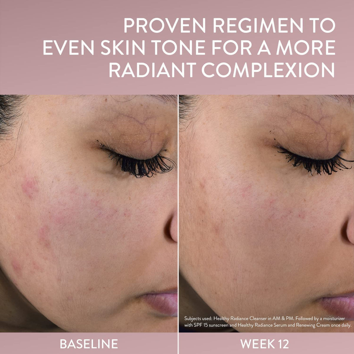 Cetaphil Healthy Radiance Brightness Refresh Face Toner - Cetaphil Official Imagery - 4