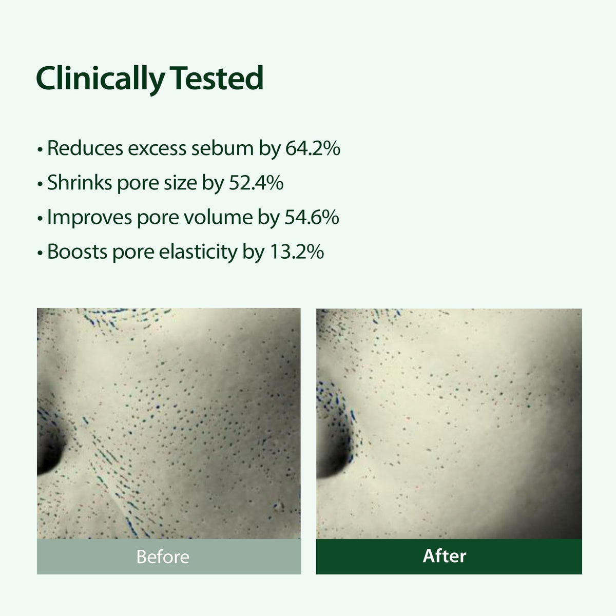BLITHE Targeted Pore Serum with 22 Niacinamide for Oil - BLITHE Official Imagery - 5