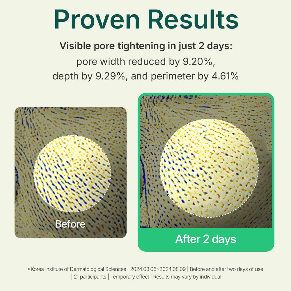 CENTELLIAN 24 Madeca Tea Tree AC Soothing Powder for Sebum Control - CENTELLIAN 24 Official Product View 4