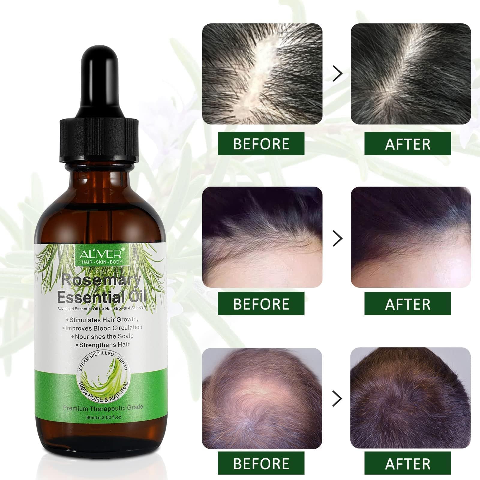 ALIVER Pure Natural Rosemary Essential Oils - & Hair Growth Scalp Oil for Dry Damage - ALIVER Official Product View 8