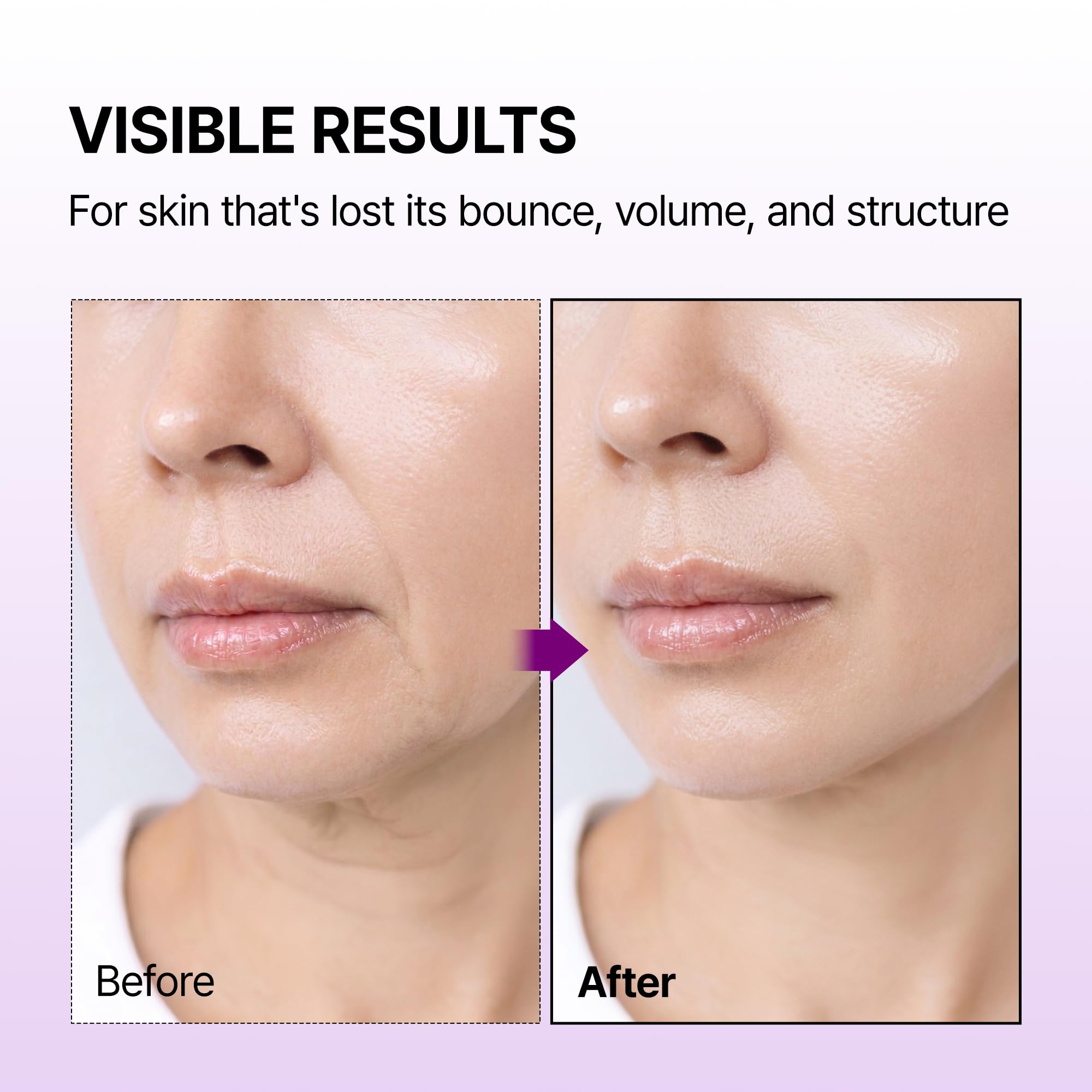Dr.Melaxin Calcium Bonding Serum with REBORNIC 10,000ppm, - Dr.Melaxin