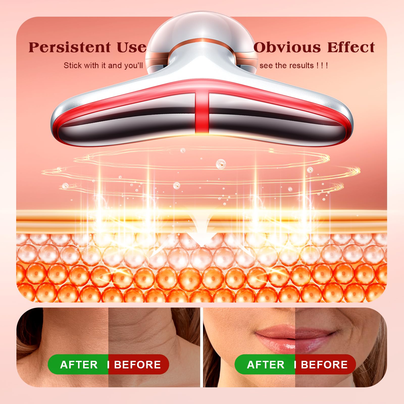 Pedete Facial Massager 7 Colors Red Light Therapy for Face - pedete Official Imagery - 5