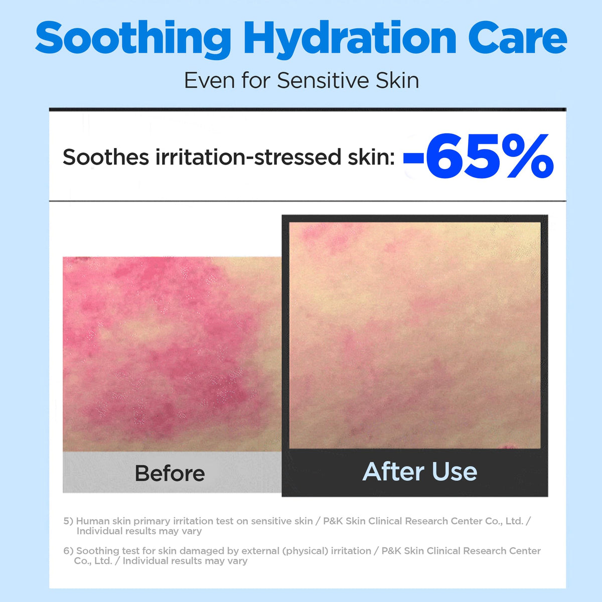 WELLAGE Real Hyaluronic Soothing Cream 100 2 7 oz - WELLAGE Official Imagery - 4