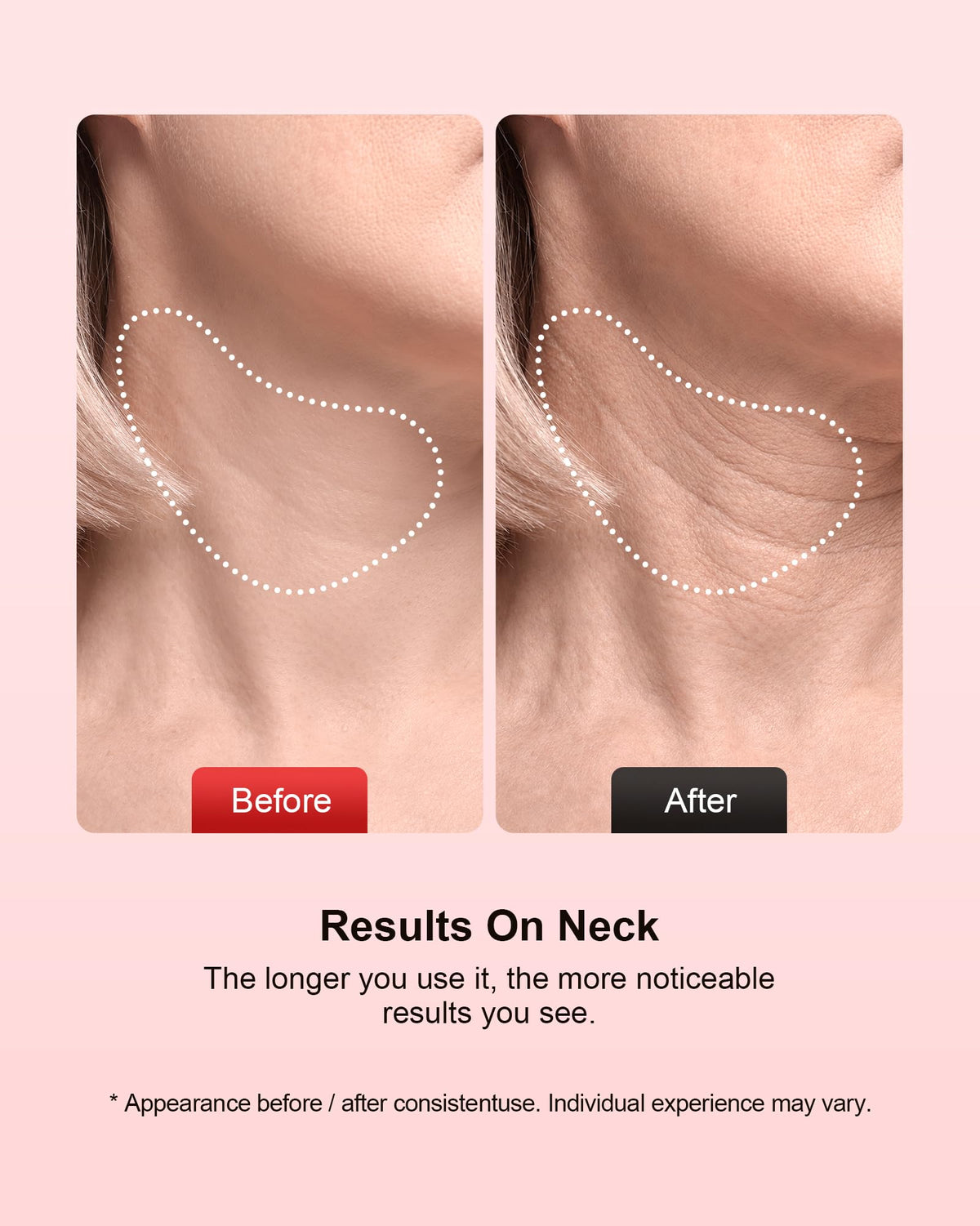 Facial Massager 7 Colors Red Light Therapy for Face and Neck - pedete Official Imagery - 8