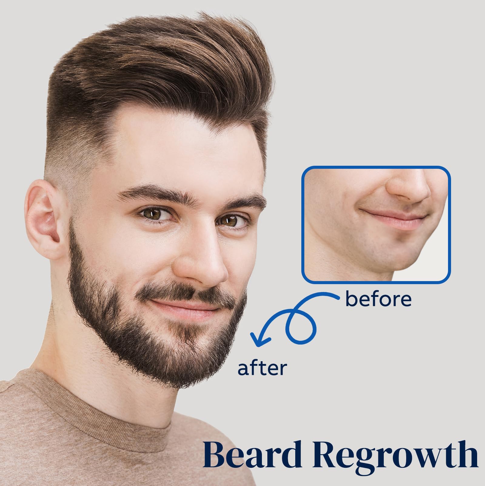 FUZYAT 5% Minoxidil Beard and Hair, Minoxidil Hair Growth Spray with Biotin & - FUZYAT Official Product View 4