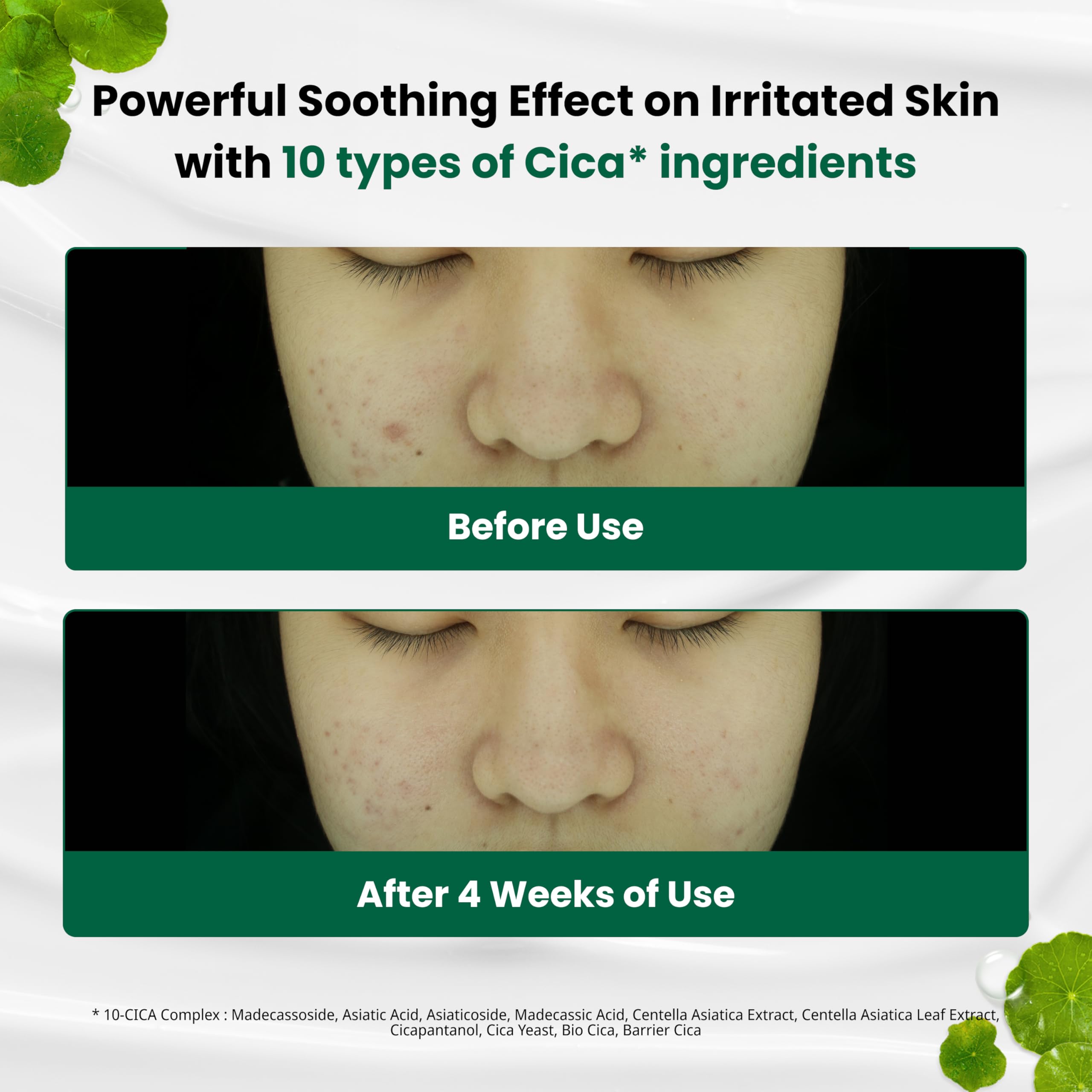 Dr.G Red Blemish Clear Soothing Korean Moisturizer Face Cream, - Dr.G