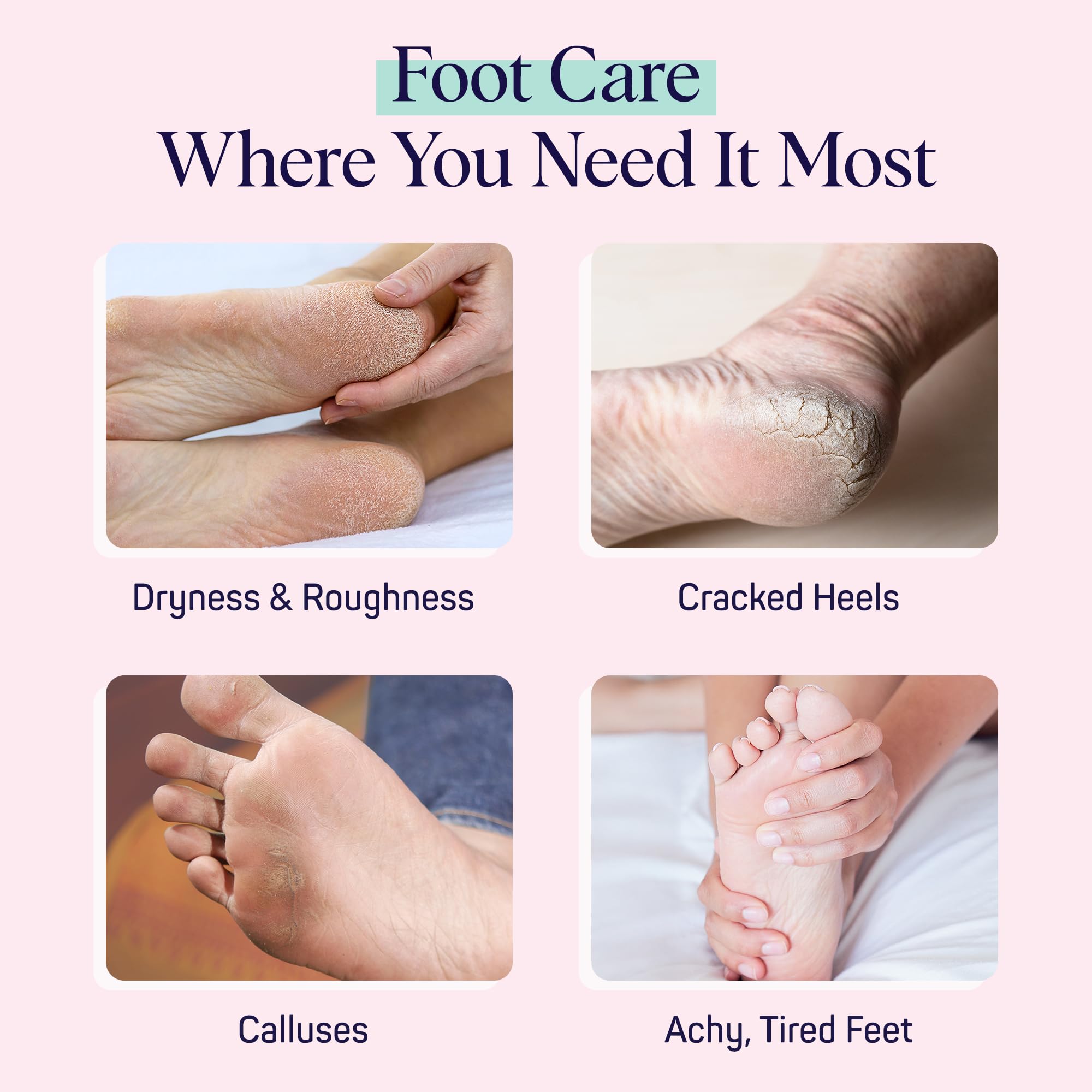 SpaLife Moisturizing Foot Sockies | Foot Mask for Dry Cracked Feet | Tea Tree Oil Softening Booties | Callus Remover Alternative | Self Care Gifts for Women | 8 Pack