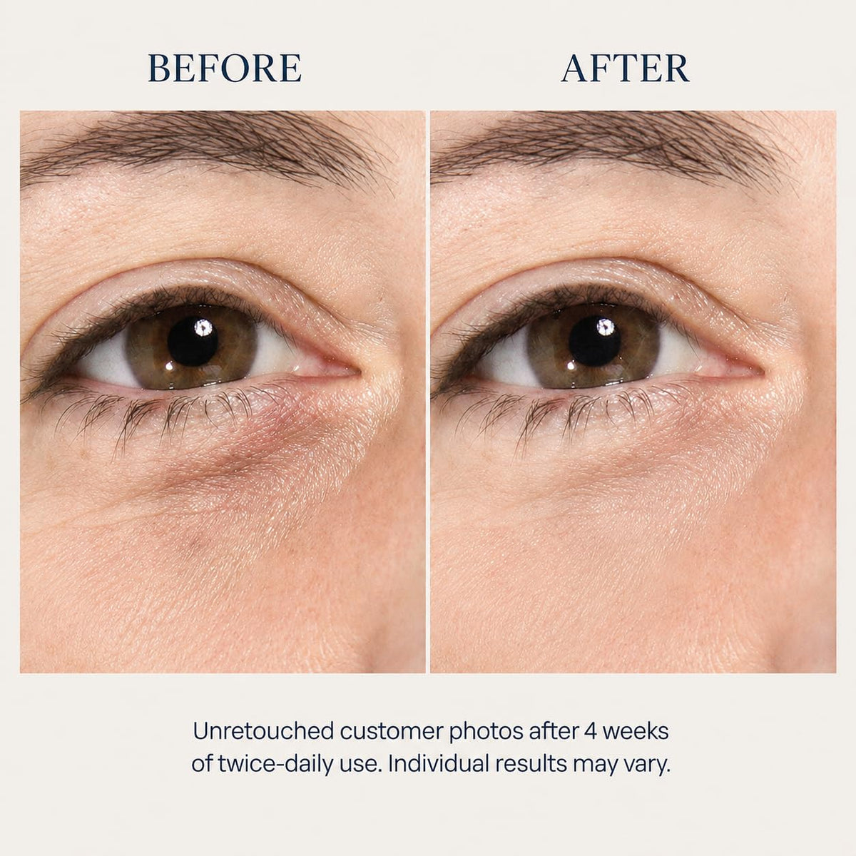 Osmotics Under Eye Rejuvenator Peptide Eye Serum for Dark - Osmotics Cosmeceuticals Official Imagery - 5