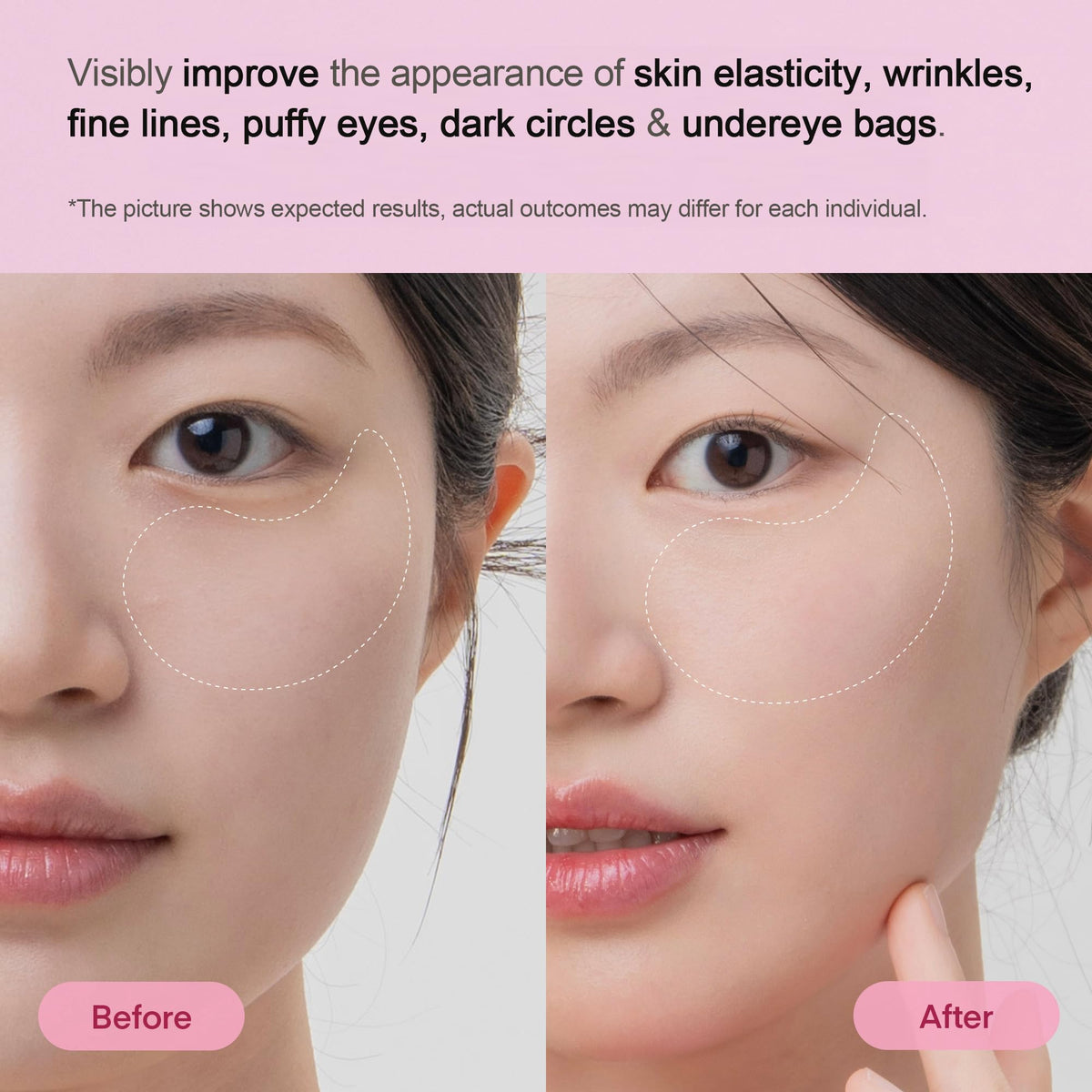 TEREZ HONOR Peptide Collagen Under Eye Patches - TEREZ & HONOR Official Imagery - 5