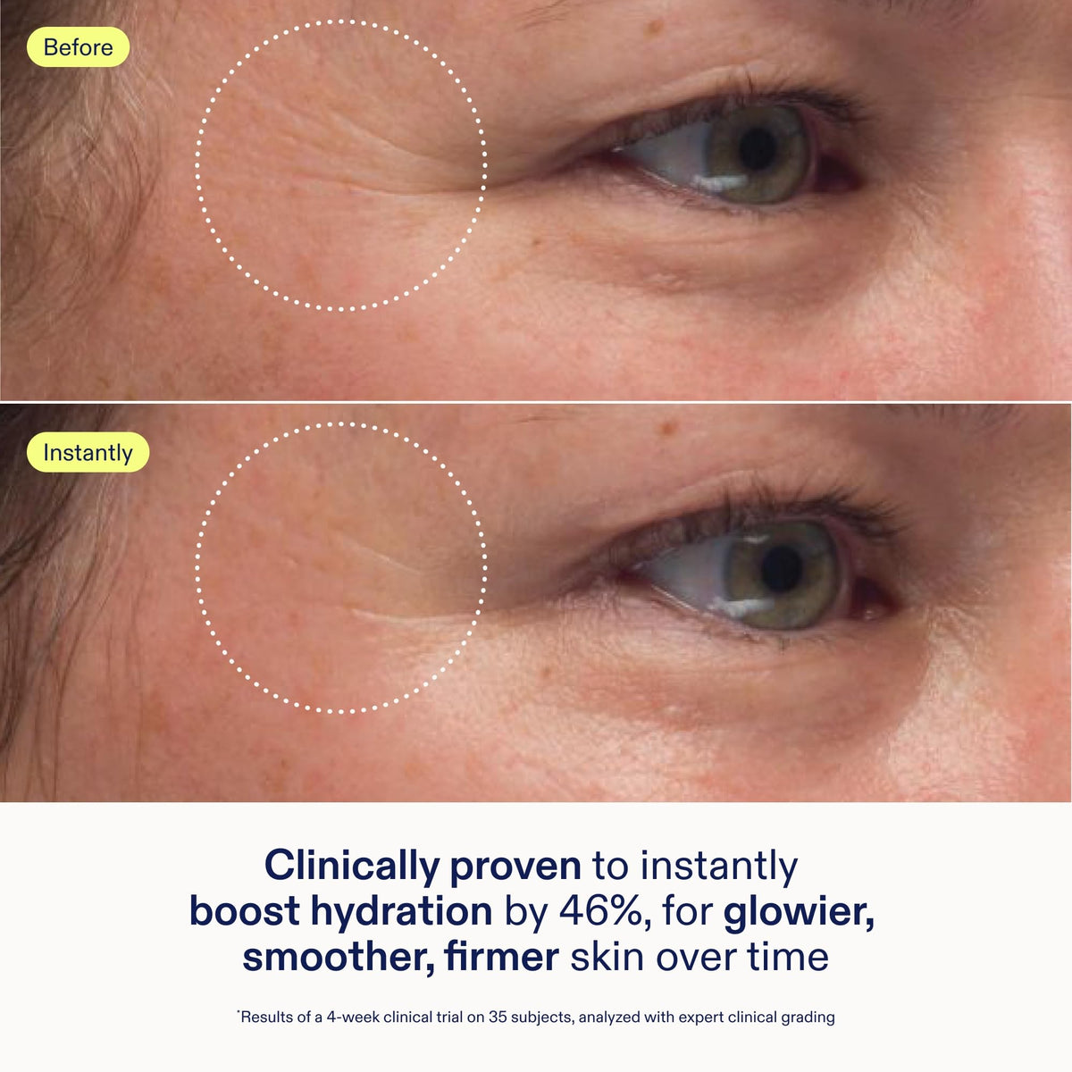 Skinfix Triple Lipid Peptide Cream - Skinfix Official Product Imagery - 4