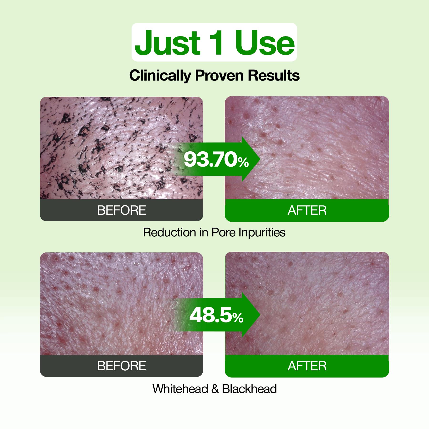 FULLY Green Tomato Pore Clay Mask Cleanser for Deep Cleansing, 4.05 fl oz - FULLY Official Product View 5
