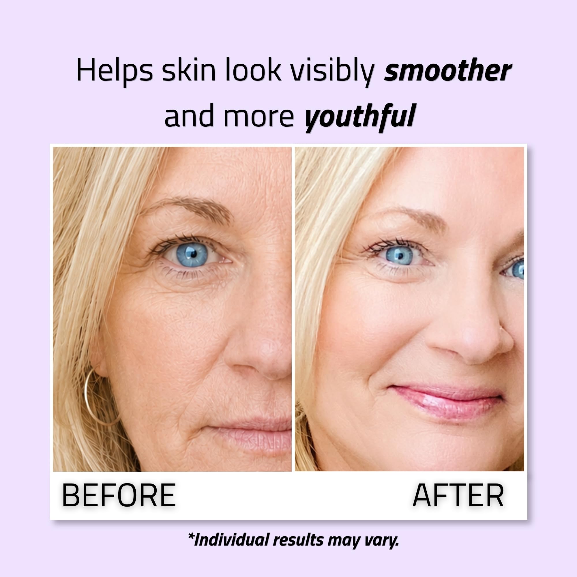 YEOUTH Anti Aging Serum for Face for More Even and Firmer - YEOUTH Official Imagery - 5