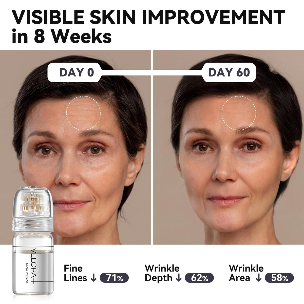 VELORA Micro Infusion System for Face - VELORA Official Imagery - 8