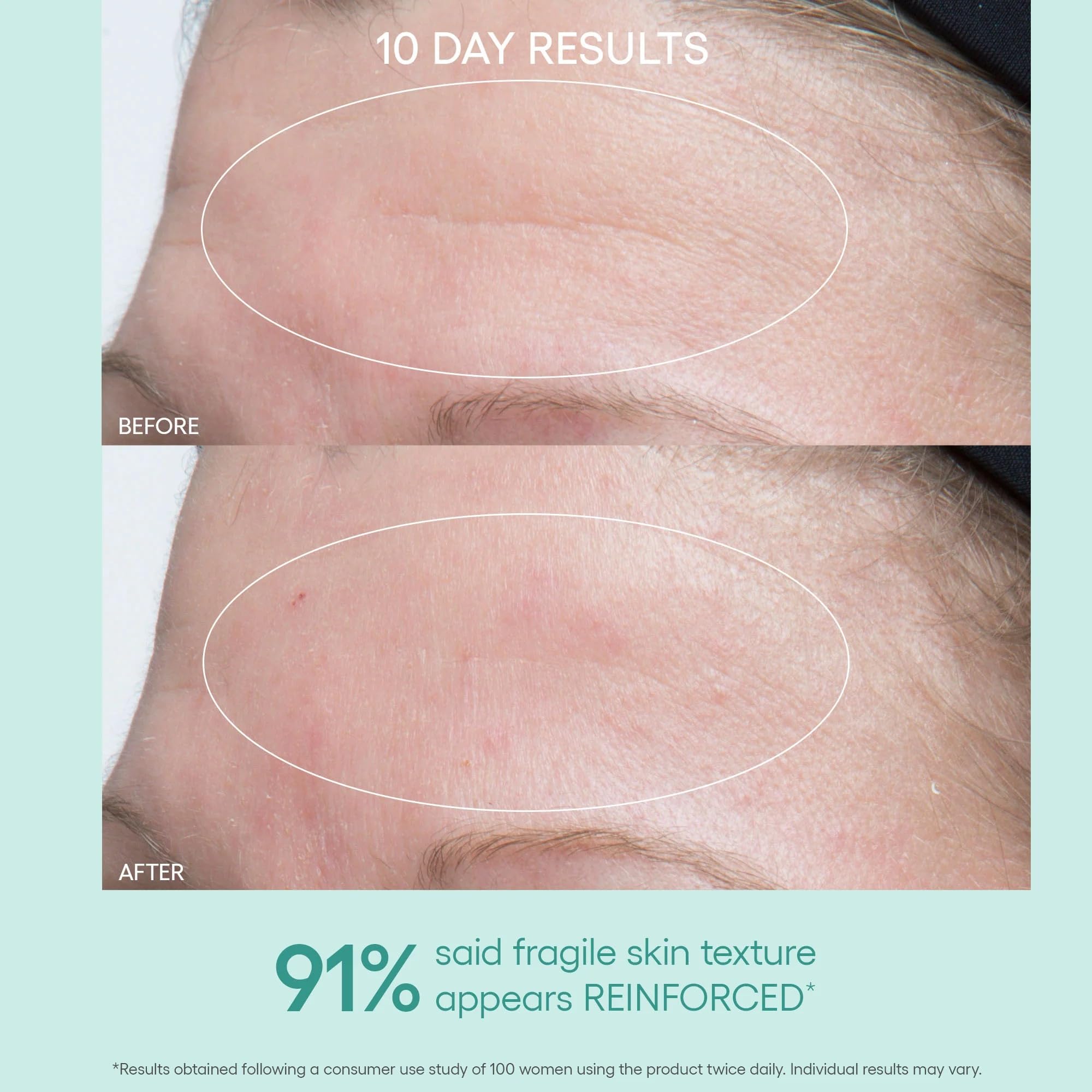 Algenist GENIUS Ultimate Anti Aging Face Cream - Algenist Official Imagery - 6